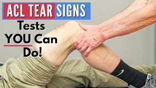 Top 3 Signs You Have an ACL tear Tests You Can Do At Home [upl. by Einhpets498]