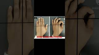 Hand x ray positioning short video [upl. by Enitnelav450]