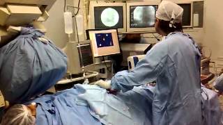 Video Ablación Electrofisiologia [upl. by Lorain]