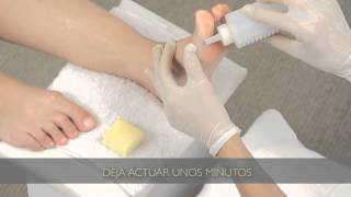 Cómo eliminar los callos de los pies  Tips para pedicuría [upl. by Nuzzi891]