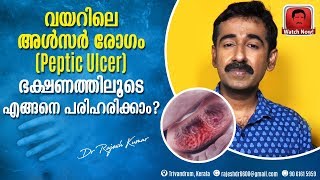 വയറിലെ അൾസർ രോഗം Peptic Ulcer ഭക്ഷണത്തിലൂടെ എങ്ങനെ പരിഹരിക്കാം [upl. by Ambrosine]