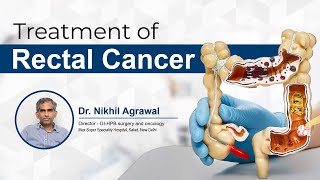 Rectal Cancer  Treatment  Dr Nikhil Agrawal [upl. by Dickie685]