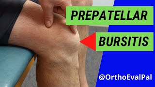 Prepatellar Bursitis Anterior knee pain and swelling [upl. by Kane]