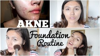 AKNE FoundationRoutine  Tipps BetterSkinwithAnna [upl. by Aeki]