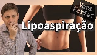 Você faria uma Lipoaspiração Tire suas dúvidas no 🌀 Giro Cirurgias Plásticas 😷 [upl. by Naoma]