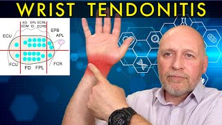 Is your Wrist Pain a Tendonitis All about Diagnosis Treatment and Recovery [upl. by Caresse510]