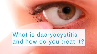 What is dacryocystitis and how do you treat it [upl. by Eissirk]