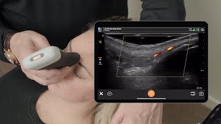 Ultrasound of the Nose and Forehead [upl. by Millwater164]