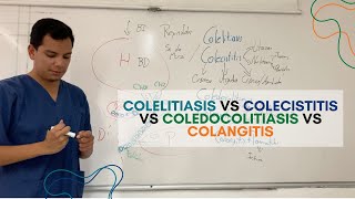 Colelitiasis vs Colecistitis vs Coledocolitiasis vs Colangitis [upl. by Ayhdiv239]