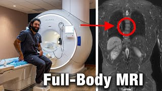 I Did a 2500 Prenuvo MRI Scan My Surprising Results [upl. by Bittner230]