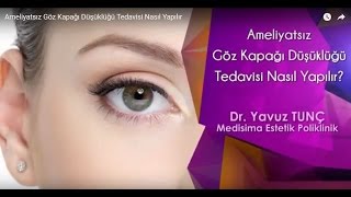 Ameliyatsız Göz Kapağı Düşüklüğü Tedavisi Nasıl Yapılır [upl. by Teleya536]