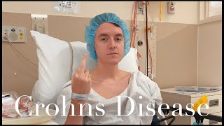 Living With Crohns Disease  My Experience After 4 Years [upl. by Deehahs675]