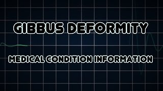 Gibbus deformity Medical Condition [upl. by Caritta296]