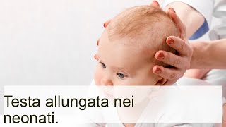 Testa allungata del neonato  Lezioni per mamme [upl. by Shulem]