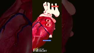 Coronary Arteries in the Surface of Heart Muscles fitmyheartnow [upl. by Hayilaa]