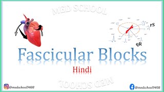 Fascicular Blocks Hindi [upl. by Nelrsa]