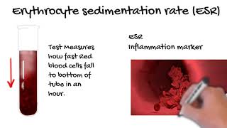 Erythrocyte Sedimentation Rate ESR what does the ESR tell you Simply Explained [upl. by Kaylil]