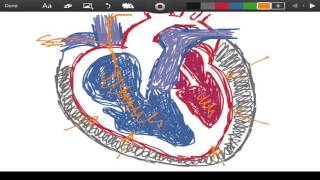 Becks Triad  Cardiac Tamponade  EMTprepcom [upl. by Oxford441]