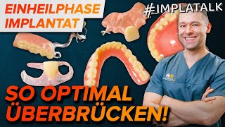 Provisorium nach Implantation  So überstehst du die Einheilphase optimal [upl. by Housen]