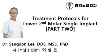 Treatment Protocols for Lower 2nd Molar Single Implant PART 2 [upl. by Bashuk]