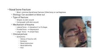 Choanal Atresia Oroantral Festula CSF Rhinorrhea Septal Hematoma Septal Abscess د ناصر العزيب [upl. by Kalikow944]