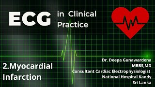 Analysis of ECGs in Myocardial Infarction  Lesson 2 [upl. by Loella]