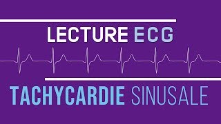 Interprétation ECG  Tachycardie Sinusale [upl. by Julietta506]