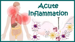 Acute Inflammation  symptoms Pathogenesis Cause of inflammation Mediators of Acute Inflammation [upl. by Duyne]