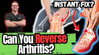 BEST 5 Ways to STOP Arthritis Pain Big 2023 New SECRETS [upl. by Woolley403]