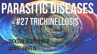 Parasitic Diseases Lectures 27 Trichinellosis [upl. by Setiram771]