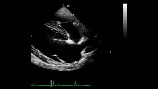 Atrial Septal Defect  Dog Standard Poodle Right Parasternal LongAxis View [upl. by Tamma807]