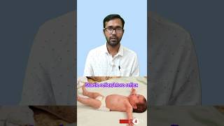 Understanding Startle ReflexMoro Reflex in Babiesmoro reflexes baby shorts [upl. by Thanh]