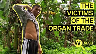 Organ Thieves Inside the Dark World of Organ Trafficking  Organ Trade Documentary [upl. by Ylatfen]