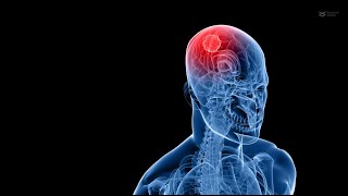 Unlocking Glioblastoma Treatment anticancer drug conjugate kills glioblastoma cells [upl. by Odrareg]