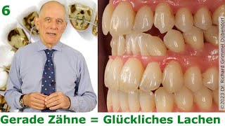 Misssion Gerade ZähneGlückliches Lachen Nr 6 Lingualtechnik präzise und unsichtbar statt Aligner [upl. by Ody]