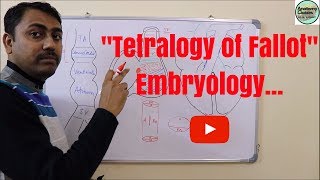 Embryological basis of Tetralogy of Fallot [upl. by Alyosha]