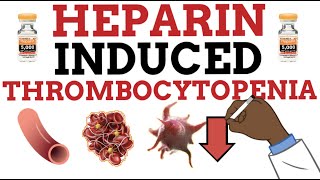 Heparin Induced Thrombocytopenia HIT MADE EASY [upl. by Susette829]