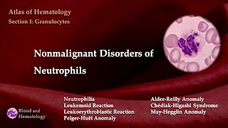 Nonmalignant Disorders of Neutrophils [upl. by Fromma320]