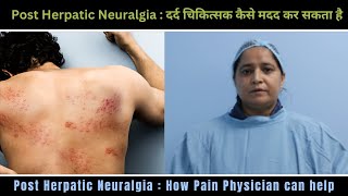 Post Herpetic Neuralgia  How Pain Physician can help By  DR AANCHAL [upl. by Elrebmik]