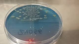 Colony characteristics of Pseudomonas aeruginosa on CLED Agar of Urine Culture [upl. by Franz906]