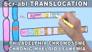 bcrabl Translocation Mechanism  Philadelphia Chromosome [upl. by Arama]