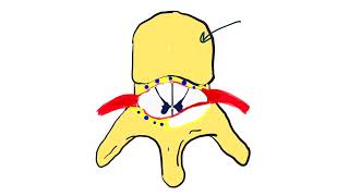 Brain Abscess amp Spinal Epidural Abscess full video [upl. by Assiren]