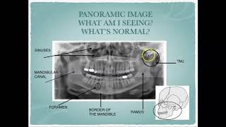 Radiographic Interpretation of Dental Anatomy [upl. by Ynohtn43]