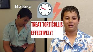 Effective Torticollis Treatment INCREDIBLE RESULTS [upl. by Annahvas]