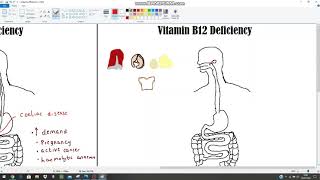 Anaemia The Clinical Picture  Haematinics Deficiencies Part 2  B12 and Folate [upl. by Manuel]