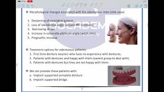 Removable prosthodontics Lec 1 [upl. by Sharma]