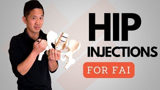 Hip Pain Hip Injections and Hip Impingement Surgery [upl. by Ztnahc814]