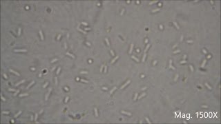 Bacteria under the Microscope E coli and S aureus [upl. by Tirb830]