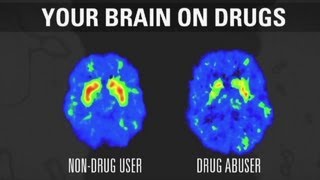 How addiction changes your brain [upl. by Ynalem440]