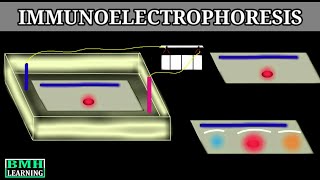 Immunoelectrophoresis [upl. by Azial67]